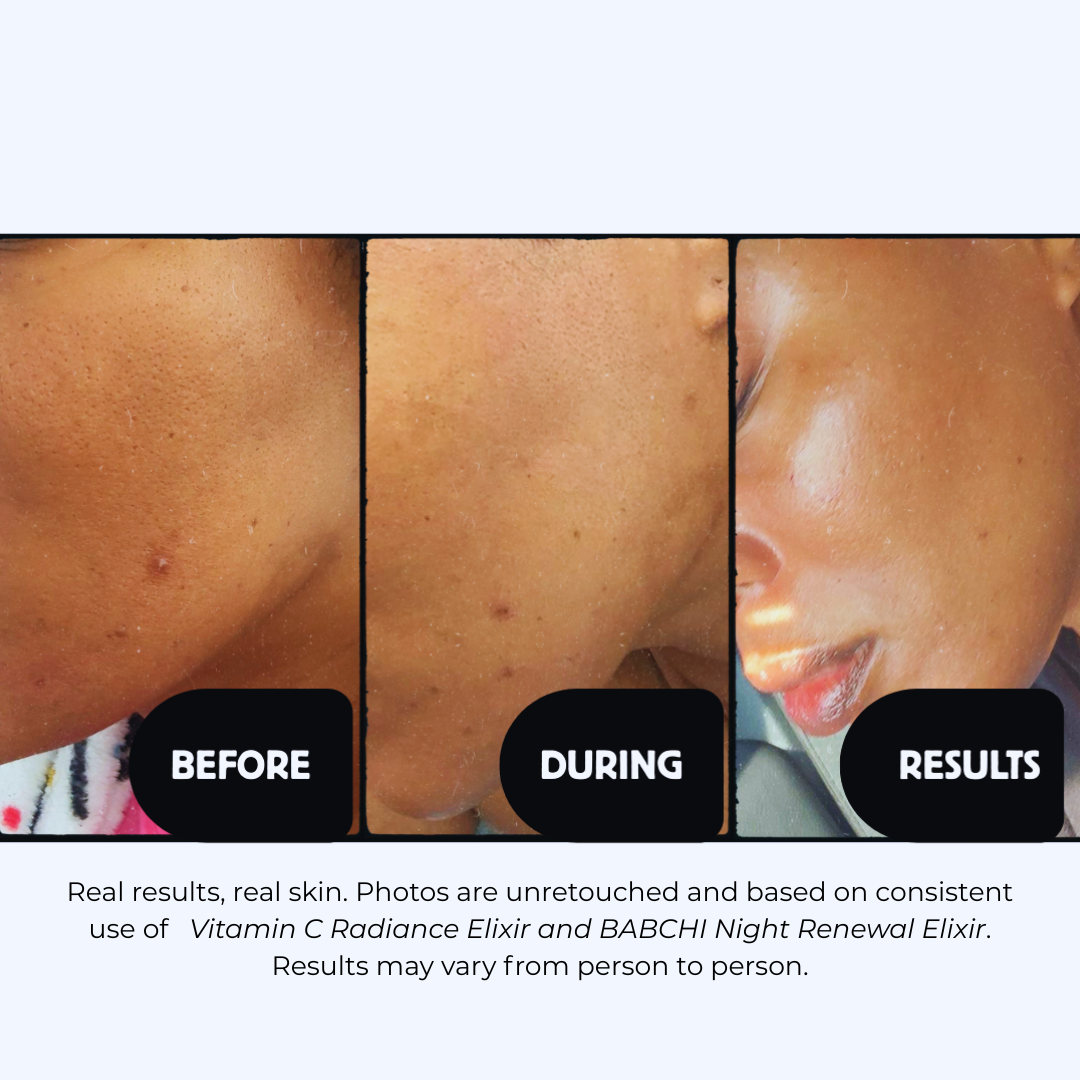 BABCHI Night Renewal Elixir